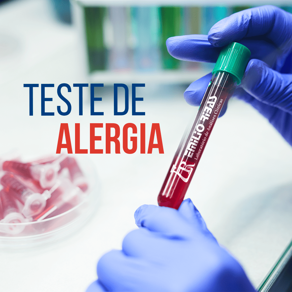 Teste de Alergia